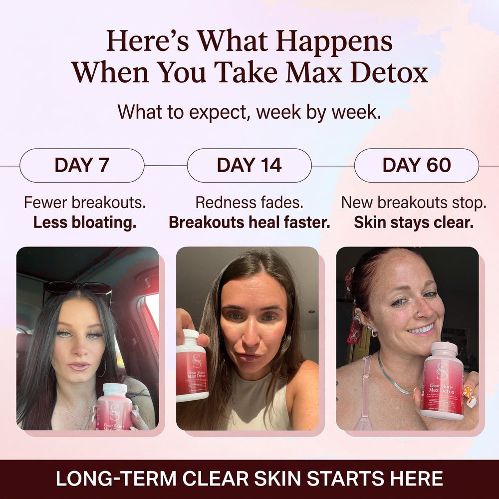 Clear Skin+ Max Detox™ | 4-Stage Acne Clearing Protocol
