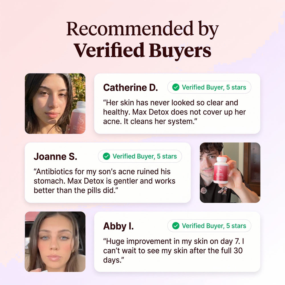 Clear Skin+ Max Detox™ | 4-Stage Acne Clearing Protocol