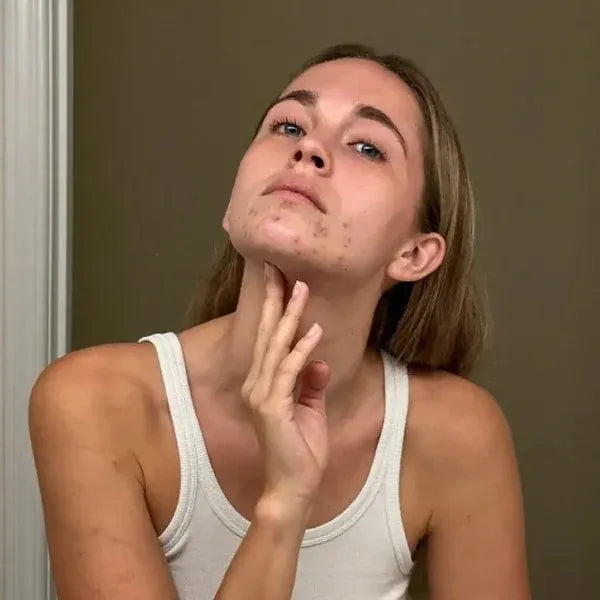 Tired of treatments that only calm the surface for a week