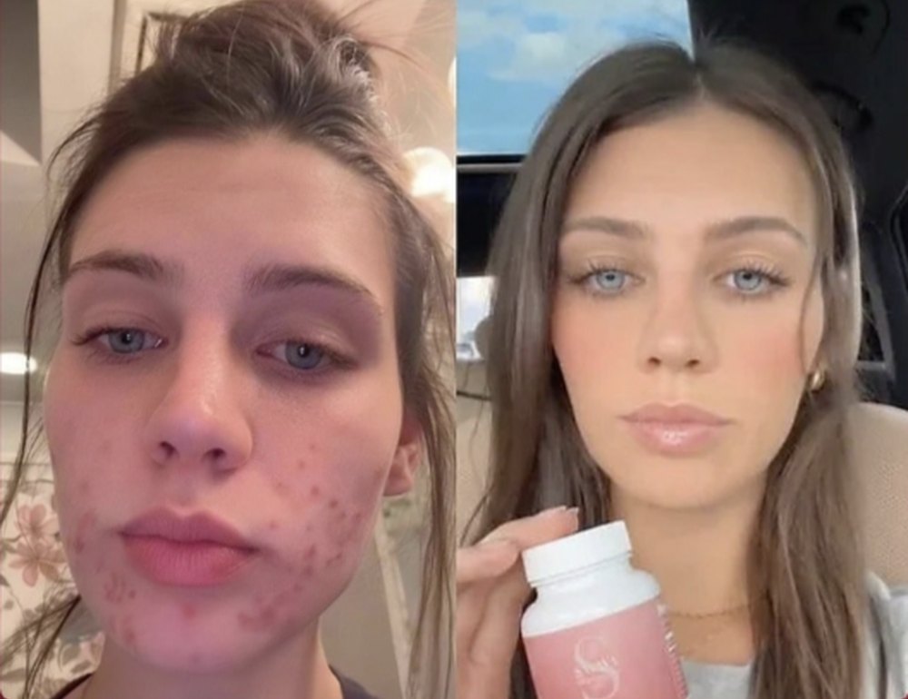 Before and after, verified buyer