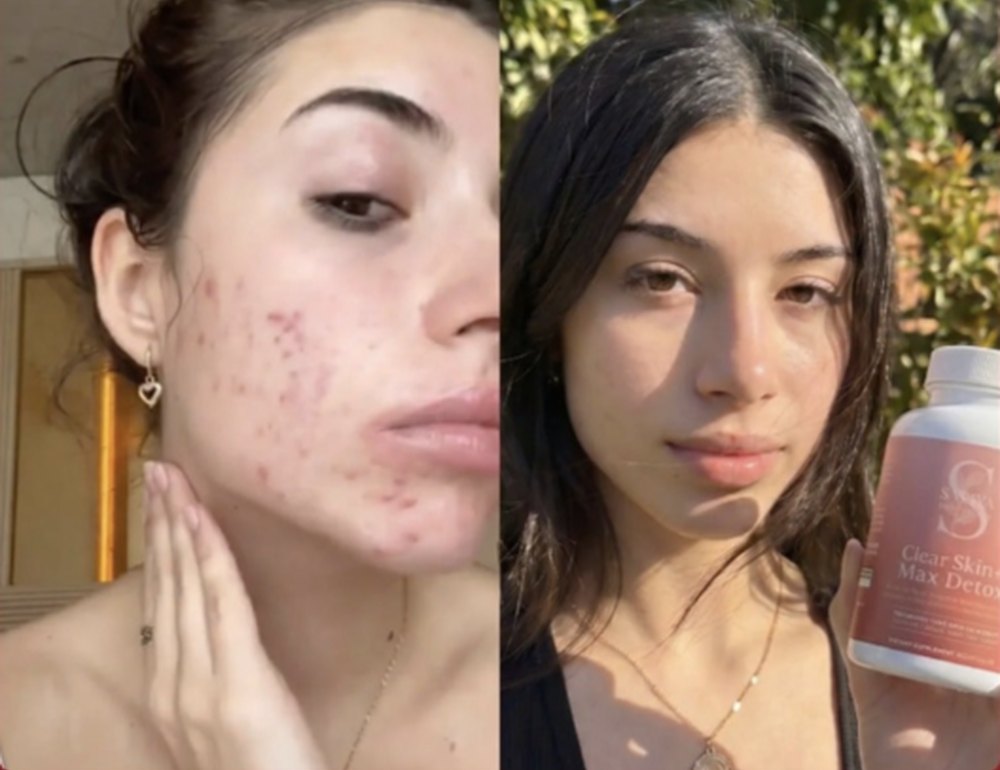 Before and after, verified buyer
