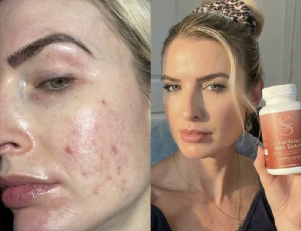 Before and after, verified buyer