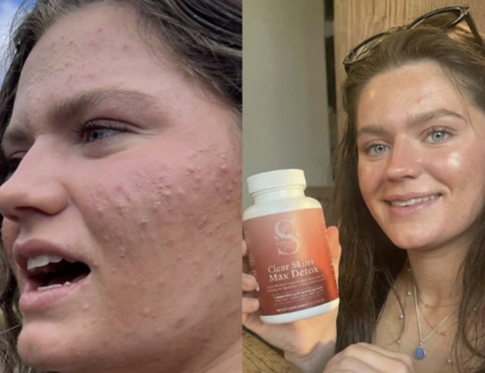 Before and after, verified buyer