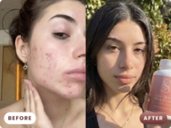 Customer before and after Max Detox