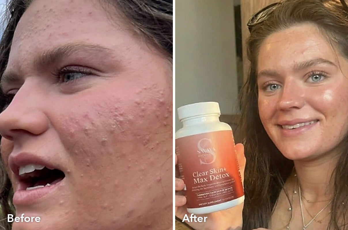 Customer before and after Max Detox