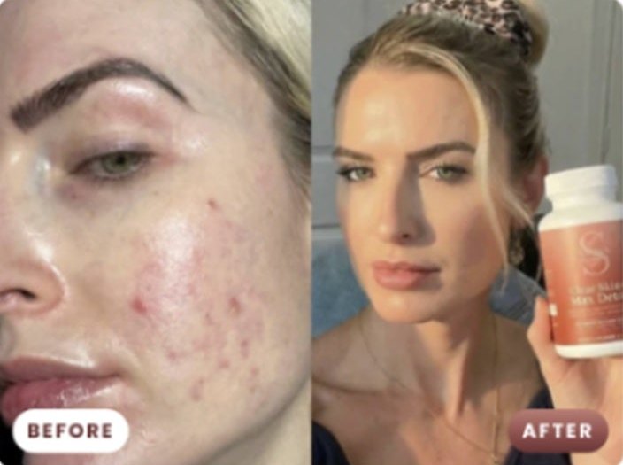 Customer before and after