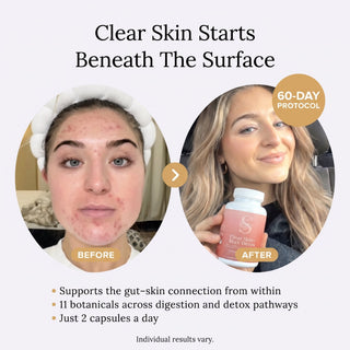 Clear Skin+ Max Detox™ | Full Detox Protocol