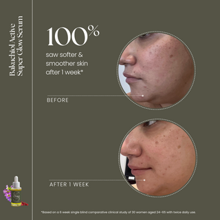 Bakuchiol Super Glow Serum