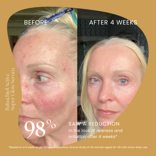 Bakuchiol Super Glow Serum
