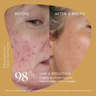 Bakuchiol Super Glow Serum
