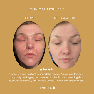 Bakuchiol Super Glow Serum