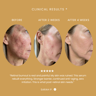 Bakuchiol Super Glow Serum