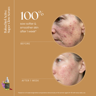 Bakuchiol Super Glow Serum