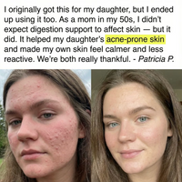 Clear Skin+ Max Detox™ | Full Detox Protocol