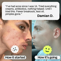 Clear Skin+ Max Detox™ | Full Detox Protocol