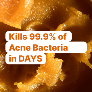 Clear Skin+ Max Detox™