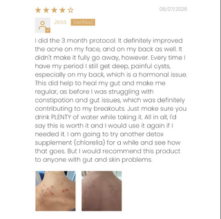 Clear Skin+ Max Detox™ | Full Detox Protocol