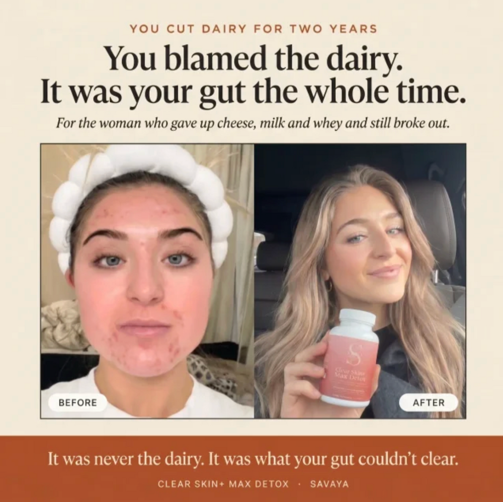 Clear Skin+ Max Detox™ | Full Detox Protocol