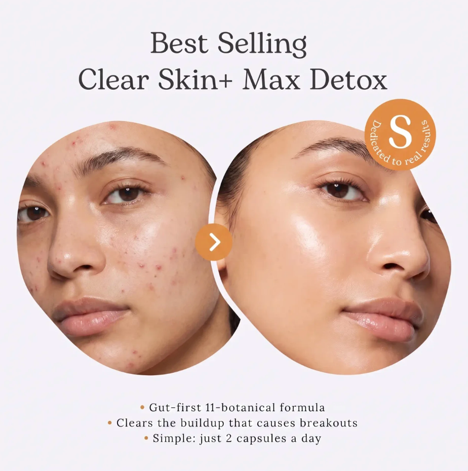 Clear Skin+ Max Detox™ | Full Detox Protocol