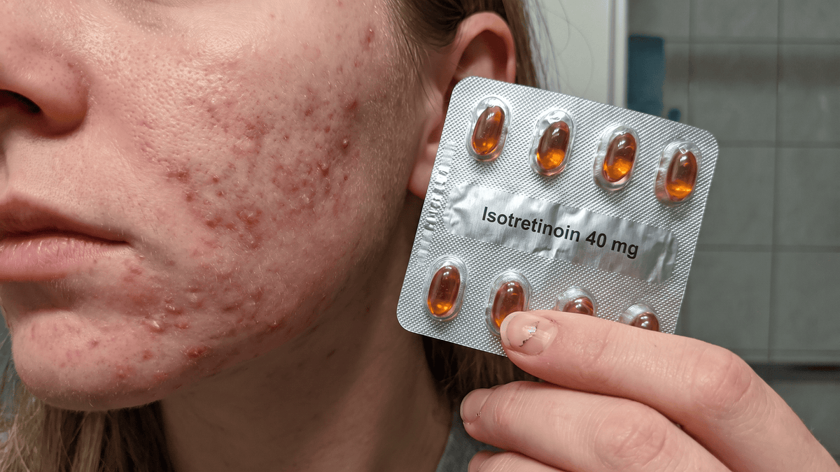 csb3-r1-accutane-B.png