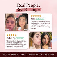 Clear Skin+ Max Detox™ | 4-Stage Acne Clearing Protocol