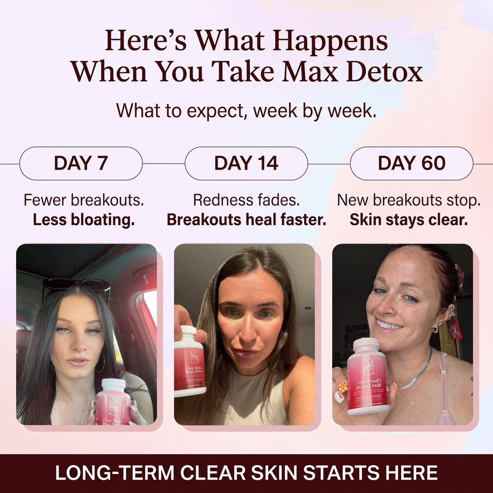 Clear Skin+ Max Detox™ | 4-Stage Acne Clearing Protocol