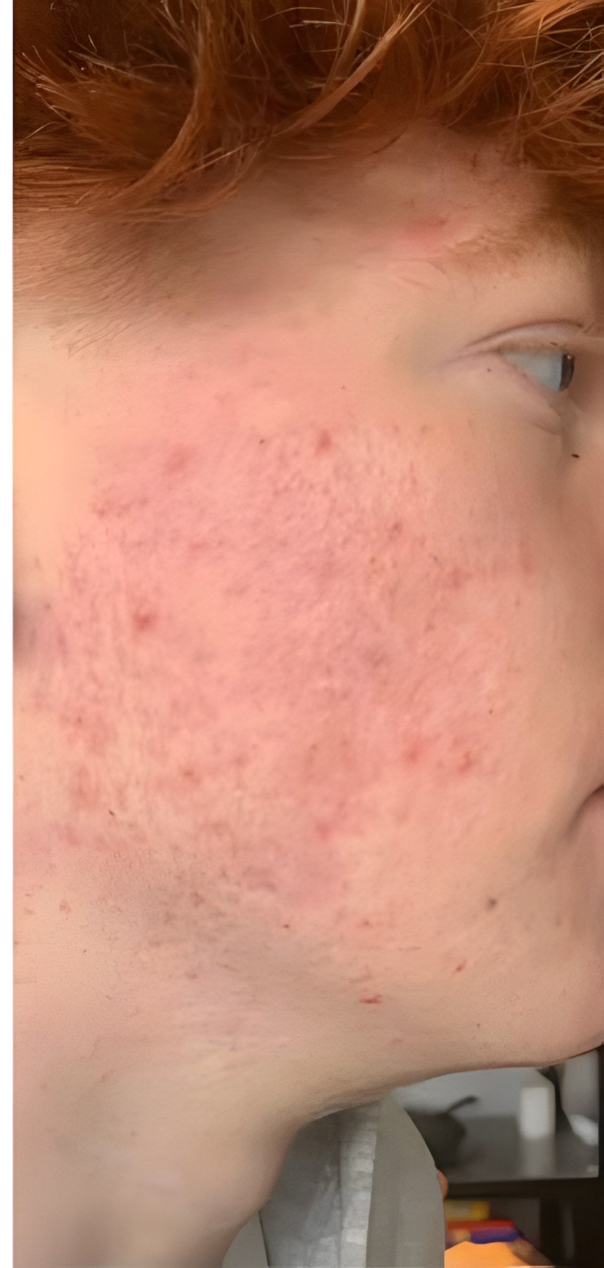 After Sea Moss+ Vital Glow™