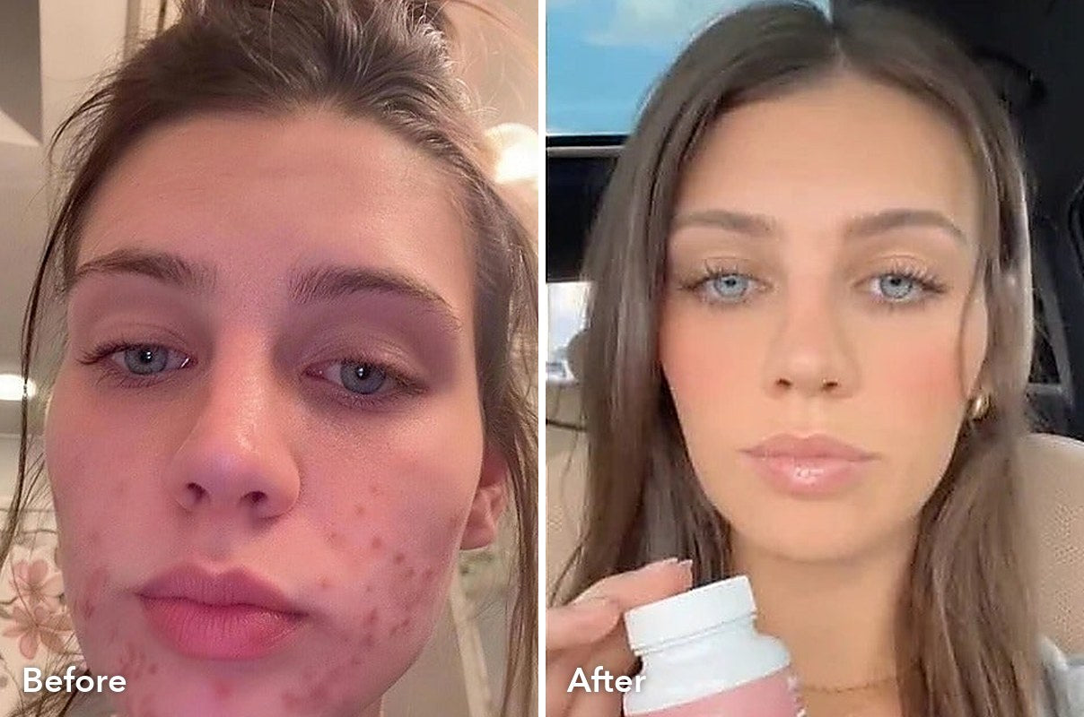 Customer before and after