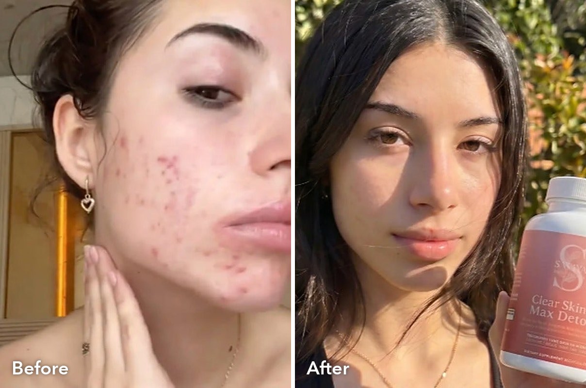 Customer before and after Max Detox
