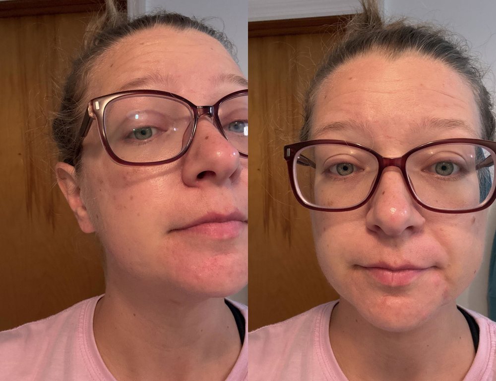 Jennifer C., before and after