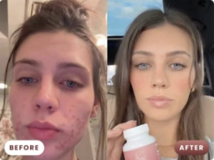 Customer before and after