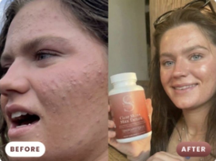 Customer before and after Max Detox