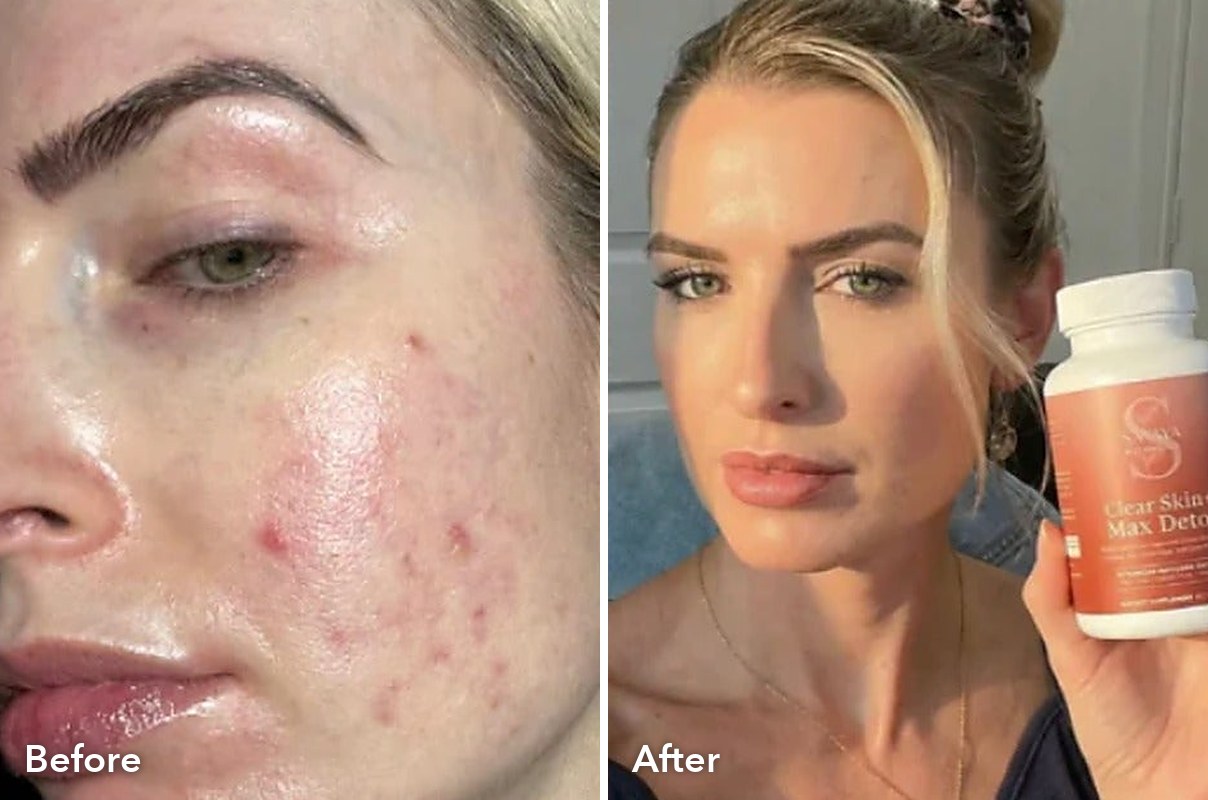 Customer before and after