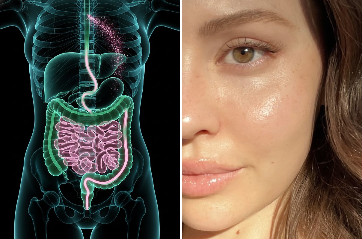 X-ray of a gut moving used hormones out, next to a woman with clear skin